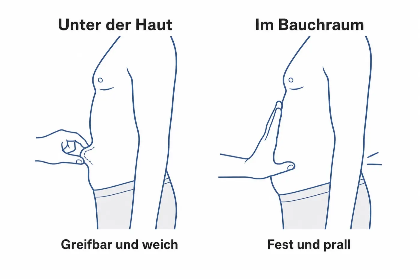 Grafik mit zwei Bauch-Silhouetten: links greifen zwei Finger eine weiche Falte, rechts liegt die flache Hand auf einem festen Bauch